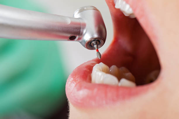Best Pediatric Emergency Dentist in Pittsboro, IN